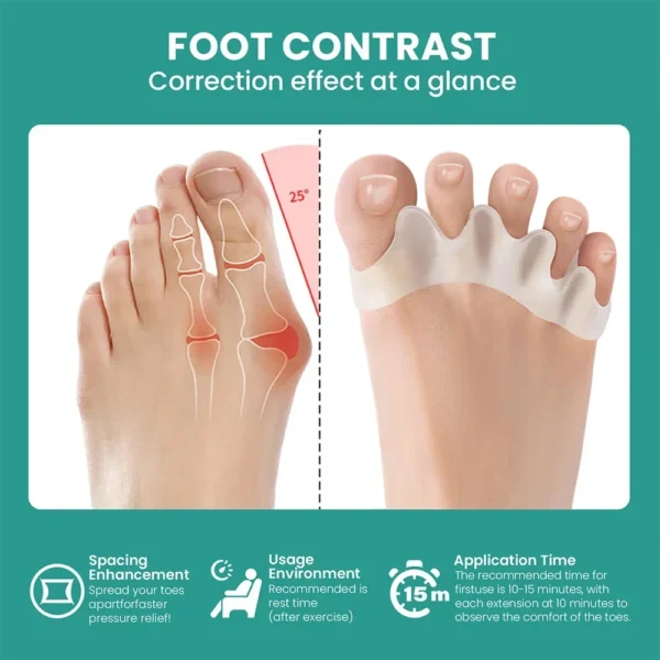 1 Pair Silicone Toe Separator Bunion Corrector Hammer Toe Corrector Soft Silicone Material for Toe Separation Foot Care Tool - Image 3