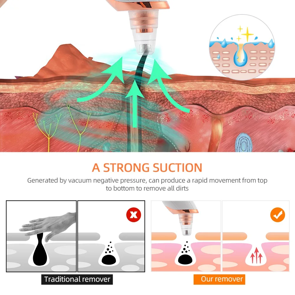 Vacuum Nose Blackhead Remover Face Cleansing Beauty Machine Facial Suction Cleaner Pimple Dead Skin Remover Extractor Skin Care - Image 4