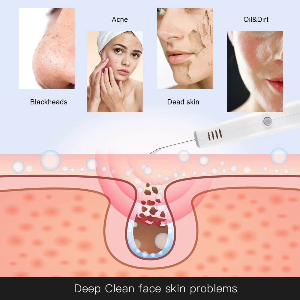 Powerful Ultrasonic Facial Skin Scrubber For Deep Cleaning Blackhead Acne Spots Remover Home Used Beauty Tool Skin Care Device - Image 4