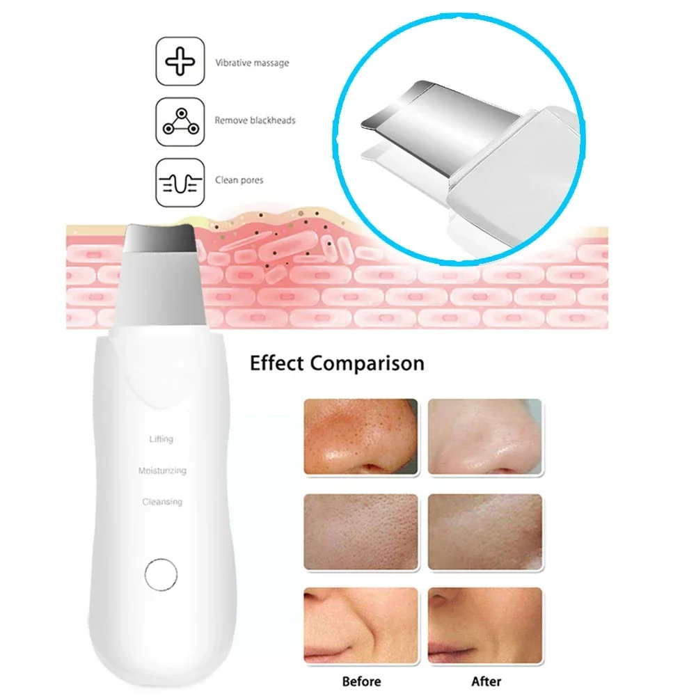 Professional No Ultrasonic Facial Skin Scrubber Ion Deep Face Cleaning Peeling Rechargeable Skin Care Device Beauty Instrument - Image 5