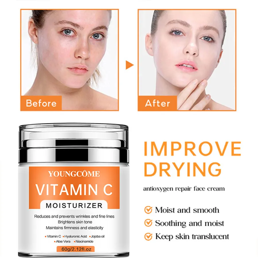 YOUNGCOME VitaminC Face Cream SkinCare Pigment Spots Freckles Remover Whitening Moisturizing Anit-Aging Beauty Health Cosmetics - Image 4